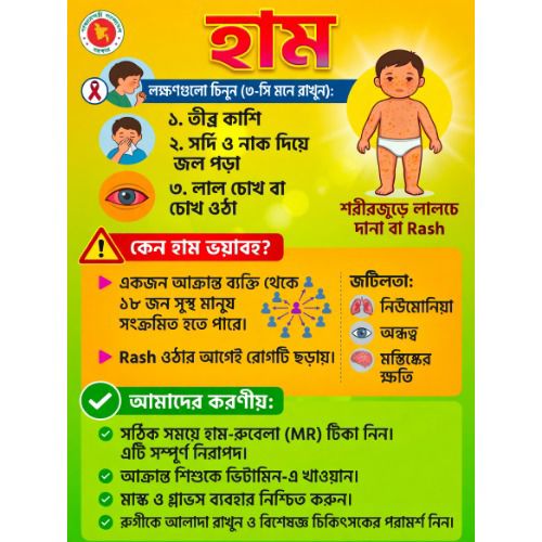 হাম (Measles): কারণ, লক্ষণ, প্রতিরোধ ও চিকিৎসা